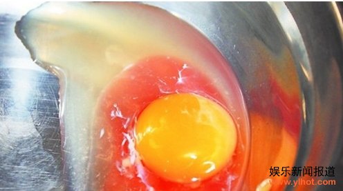 ĸ���������⵽���ѵ�٩ ������Ѫ����Ī����